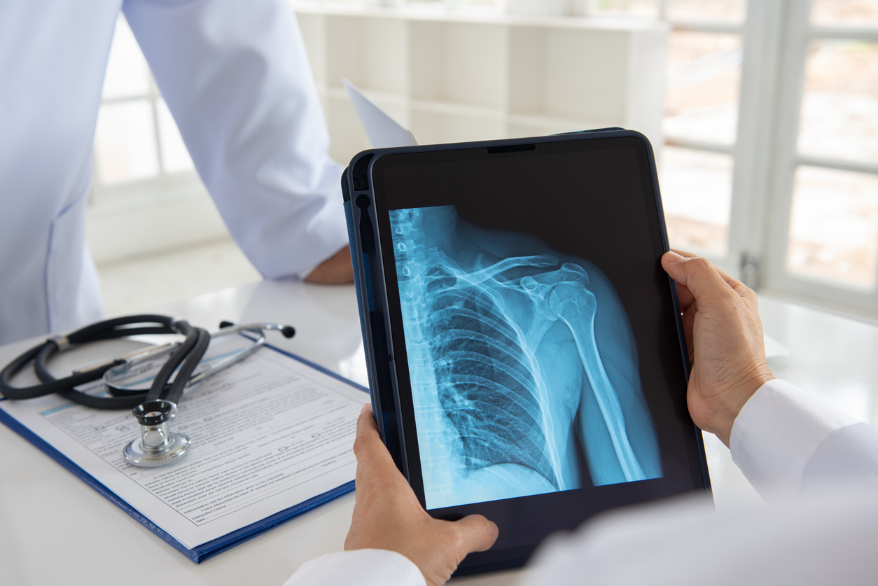shoulder joint x-ray doctor shoulder joint x-ray doctor